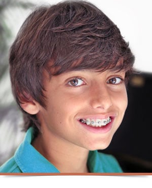 All About Braces Nelson Orthodontics in Raleigh and Fayetteville NC